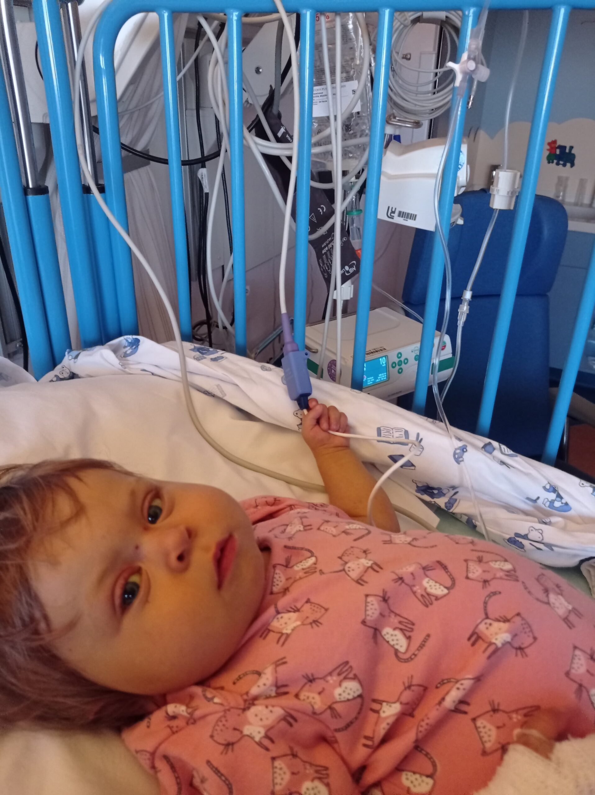 dziewczynka w różowym ubranku leży w łóżku szpitalnym z niebieskimi barierkami podłączona pod aparaturę